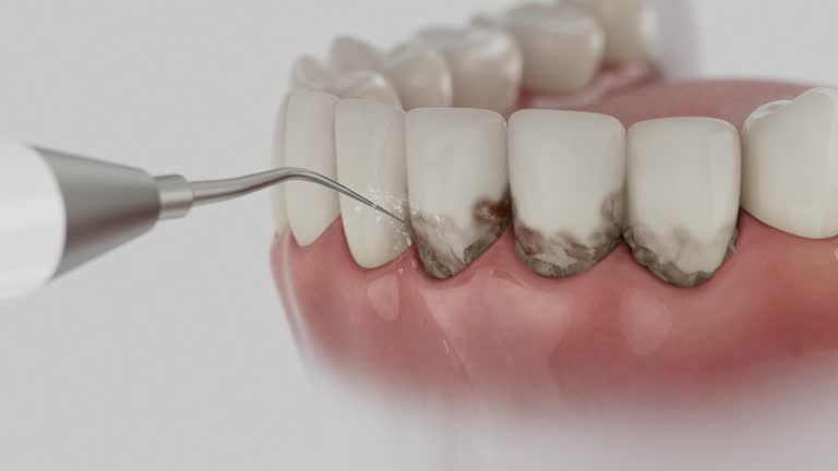 Trusted Tooth Extraction service in Deale, MD - Dentist Open Now